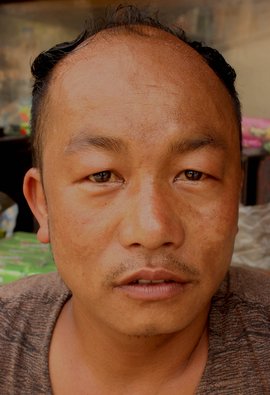 SAMEER GURUNG